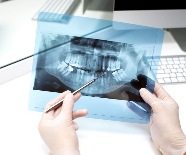dentista-analiza-foto-rayos-x